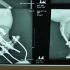 Gato ganha próteses de titânio na Bulgária