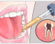 Dor de dente: remédios naturais que seu dentista não te contou