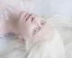 A beleza singular dos albinos