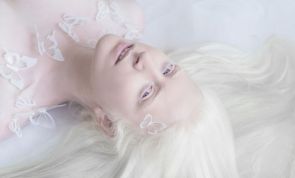 A beleza singular dos albinos
