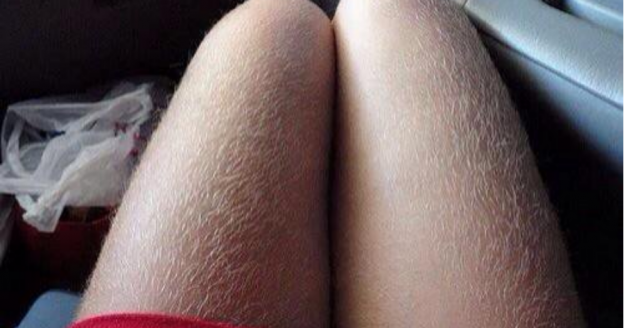 PARA QUe Serve o pelo cORPORAL?