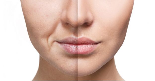 Previne o Envelhecimento