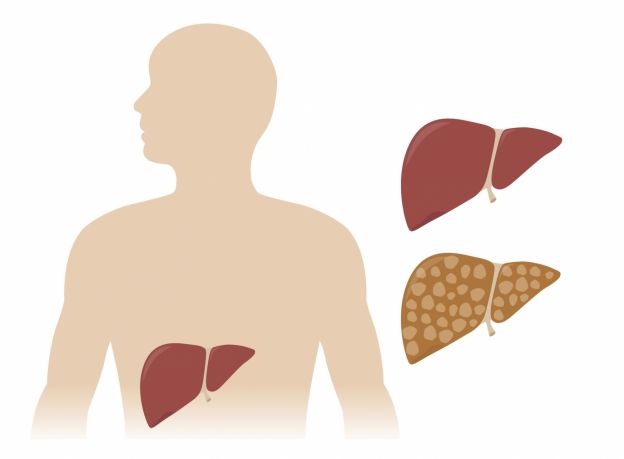 Como limpar o fígado