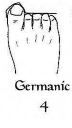 Pé germânico