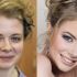 Contouring: antes e depois