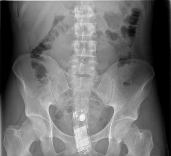 De novo, um telefone celular