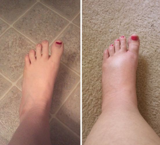 Um incrível remédio natural