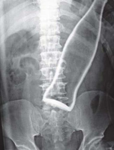 Garrafa de refrigerante