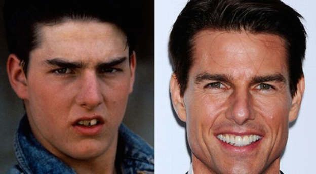 Tom Cruise