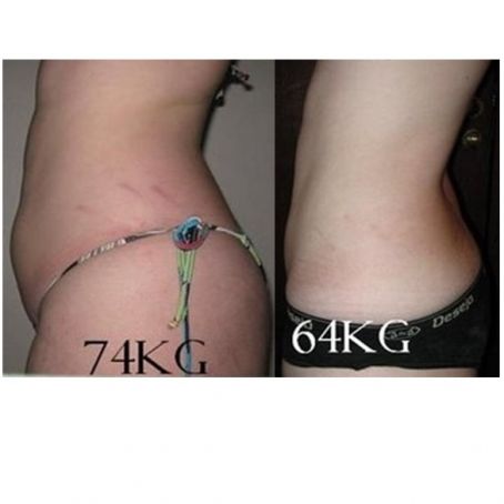 Dieta Radical – 10kg em 14 Dias