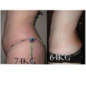 Dieta Radical – 10kg em 14 Dias