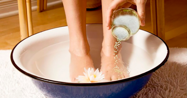 aqui Está a solução para calcanhares rachados