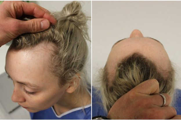 se você perde cabelos, as unhas quebram e não dorme bem, talvez o problema seja...